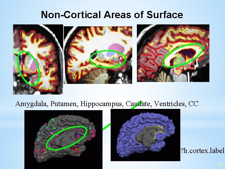 Non-Cortical Areas of Surface Amygdala, Putamen, Hippocampus, Caudate, Ventricles, CC ? h. cortex. label