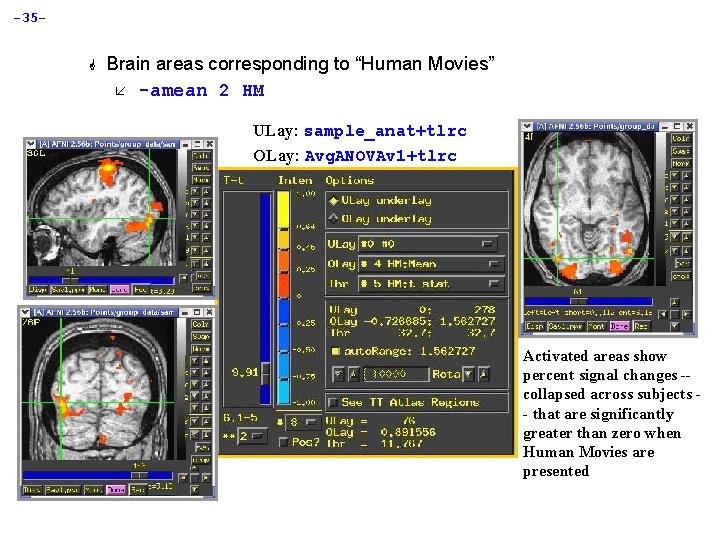 -35 G Brain areas corresponding to “Human Movies” å -amean 2 HM ULay: sample_anat+tlrc
