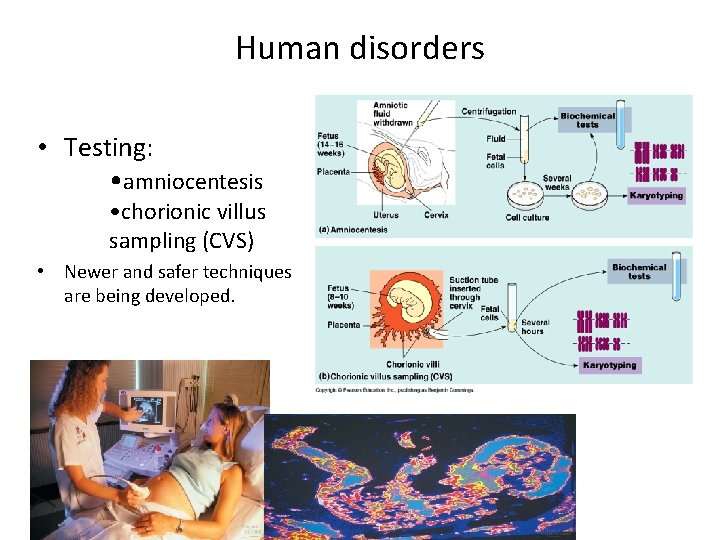 Human disorders • Testing: • amniocentesis • chorionic villus sampling (CVS) • Newer and