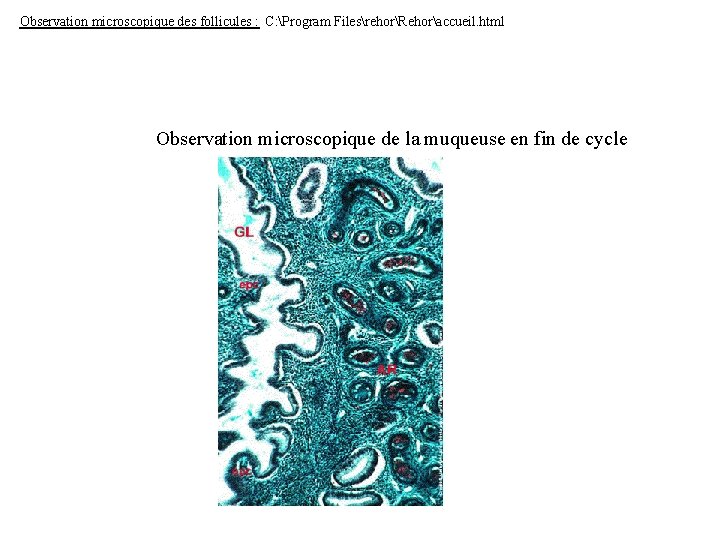 Observation microscopique des follicules : C: Program FilesrehorRehoraccueil. html Observation microscopique de la muqueuse