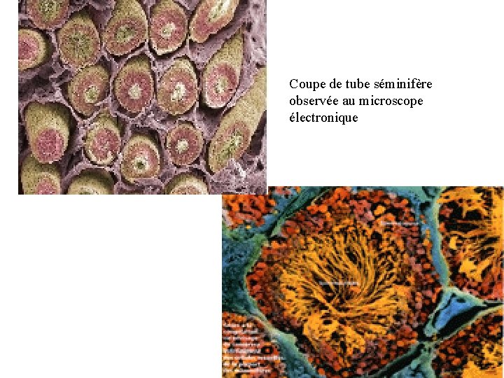 Coupe de tube séminifère observée au microscope électronique 