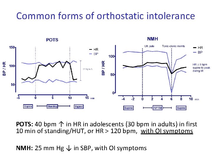 Common forms of orthostatic intolerance POTS: 40 bpm ↑ in HR in adolescents (30