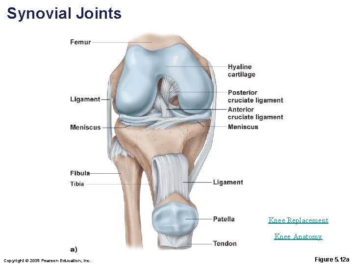 Synovial Joints Knee Replacement Knee Anatomy Copyright © 2009 Pearson Education, Inc. Figure 5.
