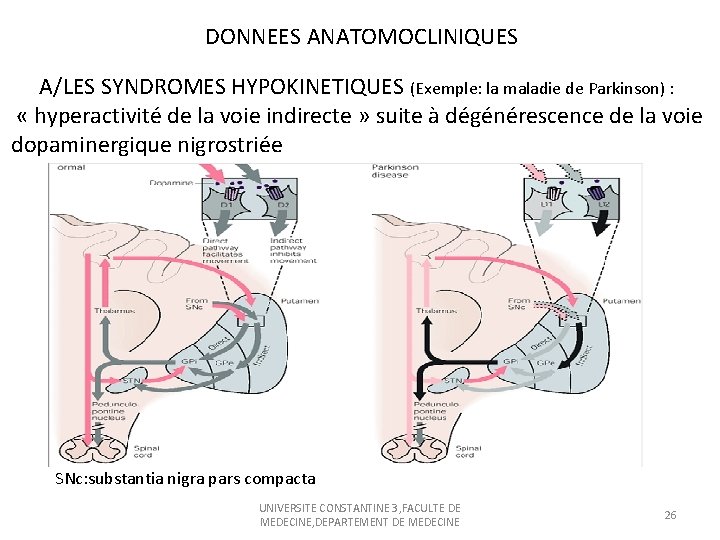 DONNEES ANATOMOCLINIQUES A/LES SYNDROMES HYPOKINETIQUES (Exemple: la maladie de Parkinson) : « hyperactivité de