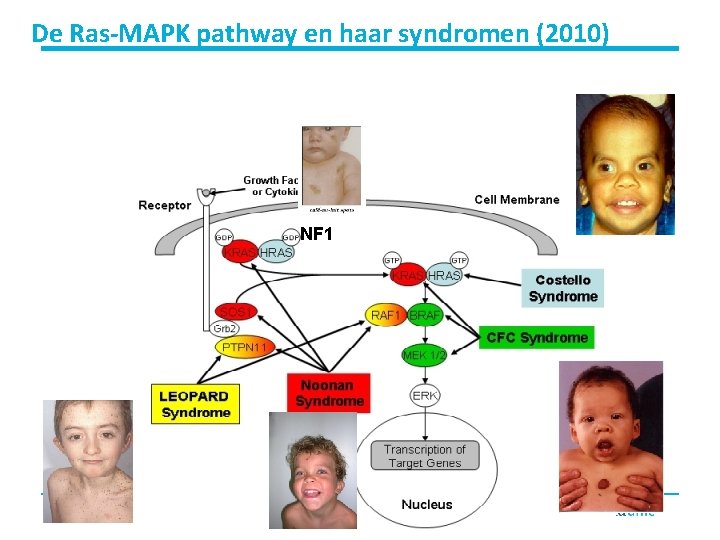 De Ras-MAPK pathway en haar syndromen (2010) NF 1 