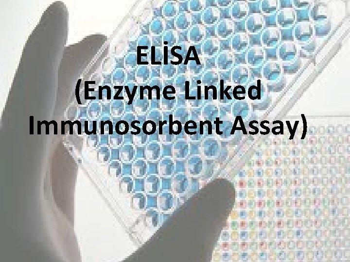 ELİSA (Enzyme Linked Immunosorbent Assay) 