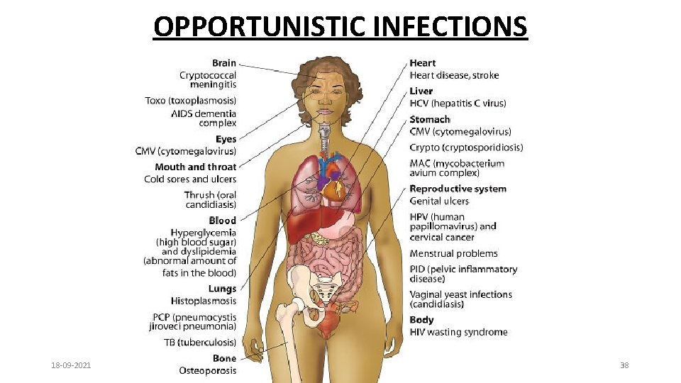 OPPORTUNISTIC INFECTIONS 18 -09 -2021 38 