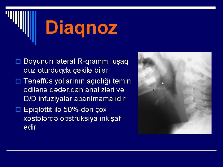 Diaqnoz o Boyunun lateral R-qrammı uşaq düz oturduqda çəkilə bilər o Tənəffüs yollarının açıqlığı