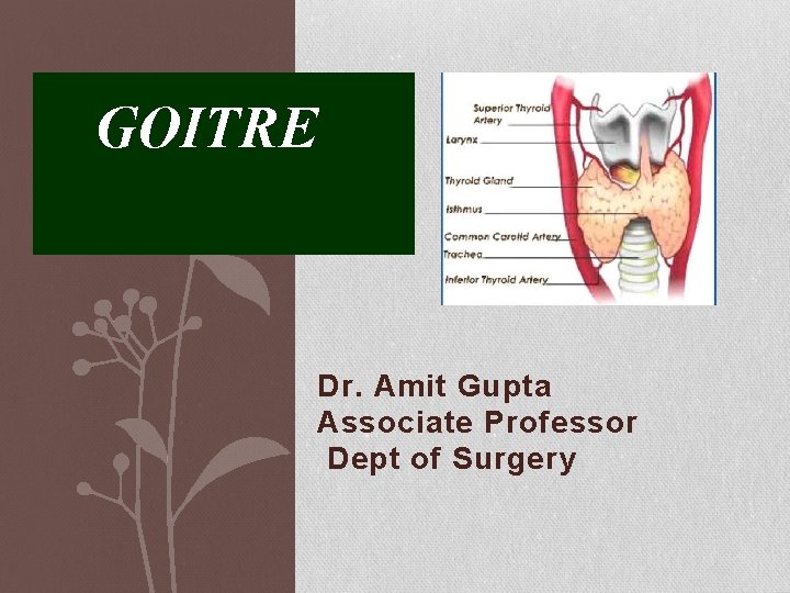 GOITRE Dr. Amit Gupta Associate Professor Dept of Surgery 