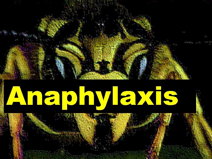 Anaphylaxis 