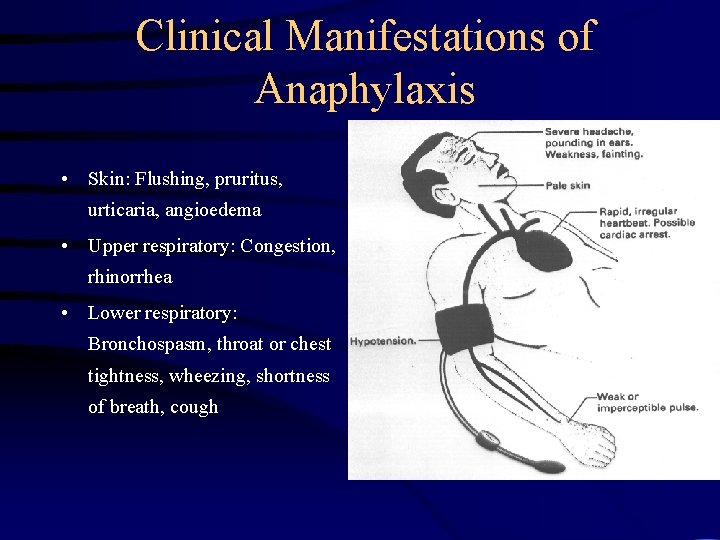 Clinical Manifestations of Anaphylaxis • Skin: Flushing, pruritus, urticaria, angioedema • Upper respiratory: Congestion,