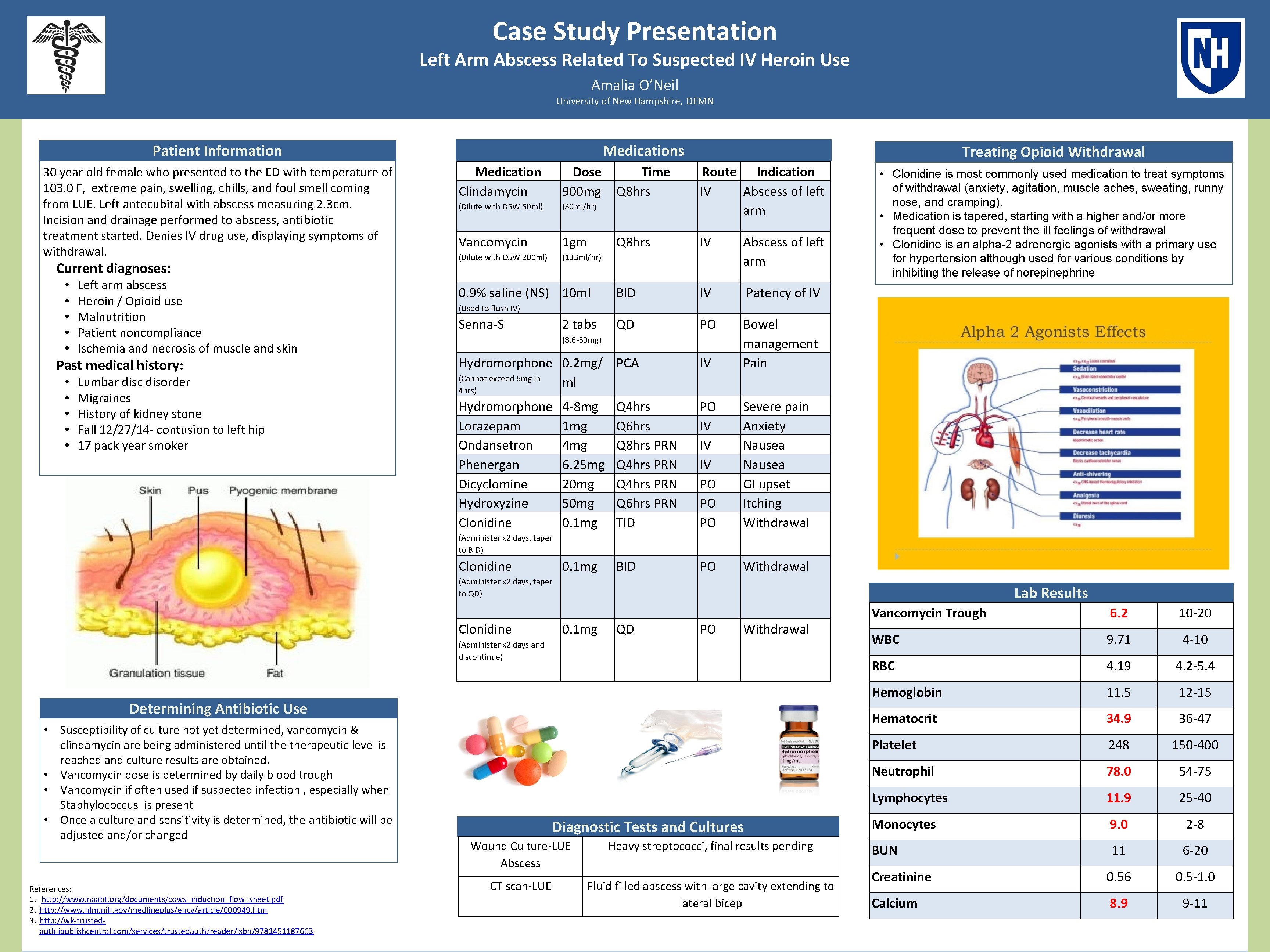 Case Study Presentation Left Arm Abscess Related To Suspected IV Heroin Use Amalia O’Neil