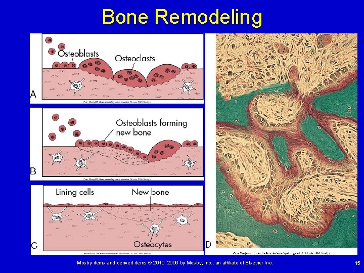 Bone Remodeling Mosby items and derived items © 2010, 2006 by Mosby, Inc. ,