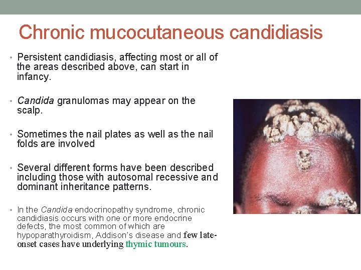 Chronic mucocutaneous candidiasis • Persistent candidiasis, affecting most or all of the areas described