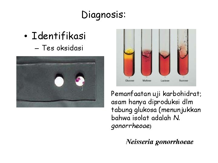 Diagnosis: • Identifikasi – Tes oksidasi Pemanfaatan uji karbohidrat; asam hanya diproduksi dlm tabung