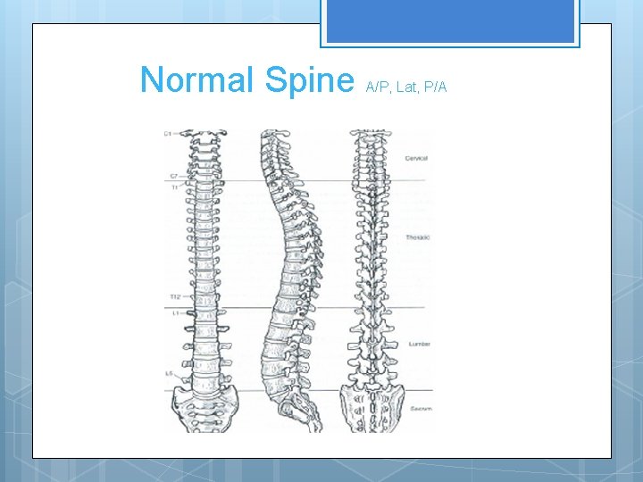 Normal Spine A/P, Lat, P/A 