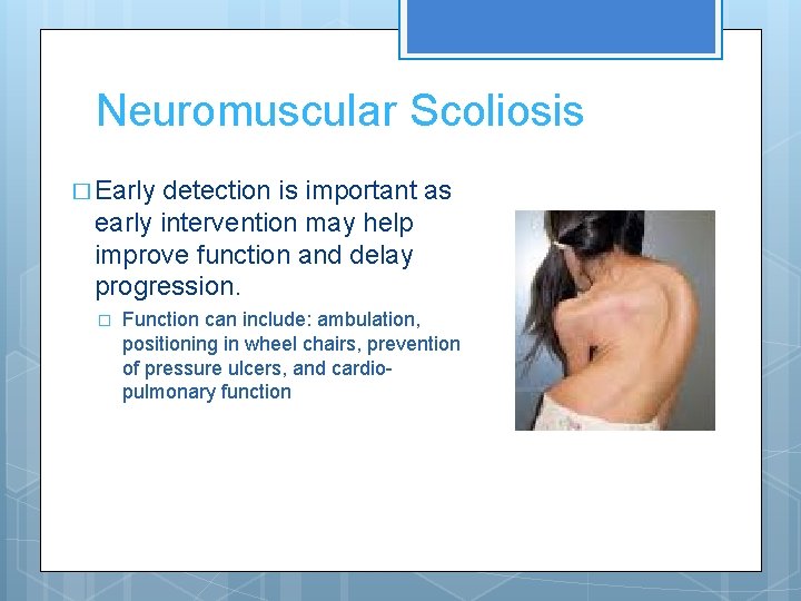 Neuromuscular Scoliosis � Early detection is important as early intervention may help improve function