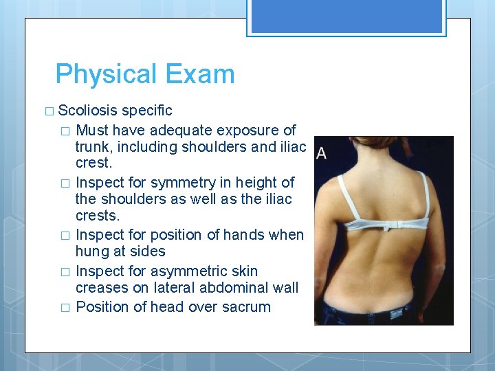 Physical Exam � Scoliosis specific � Must have adequate exposure of trunk, including shoulders