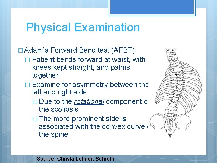 Physical Examination � Adam’s Forward Bend test (AFBT) � Patient bends forward at waist,