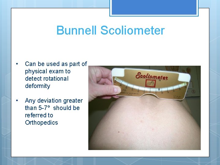 Bunnell Scoliometer • Can be used as part of physical exam to detect rotational