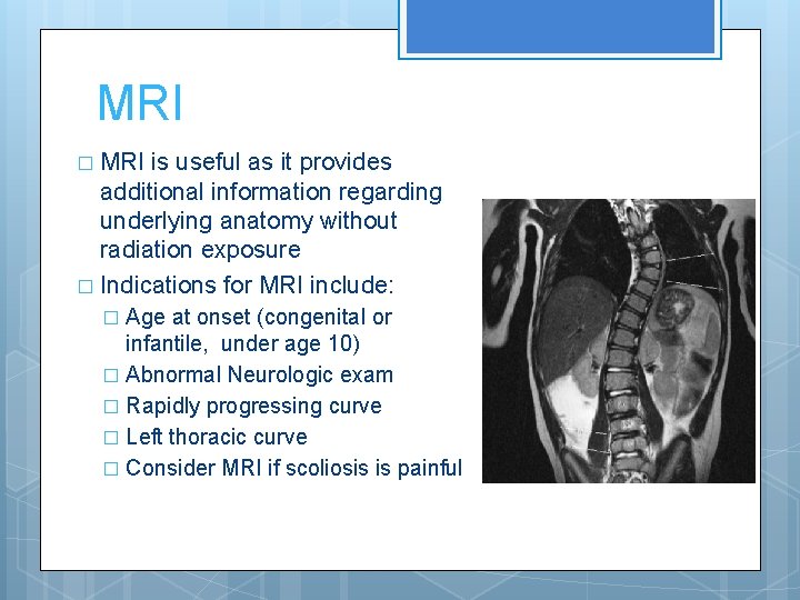 MRI � MRI is useful as it provides additional information regarding underlying anatomy without