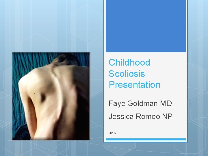 Childhood Scoliosis Presentation Faye Goldman MD Jessica Romeo NP 2016 