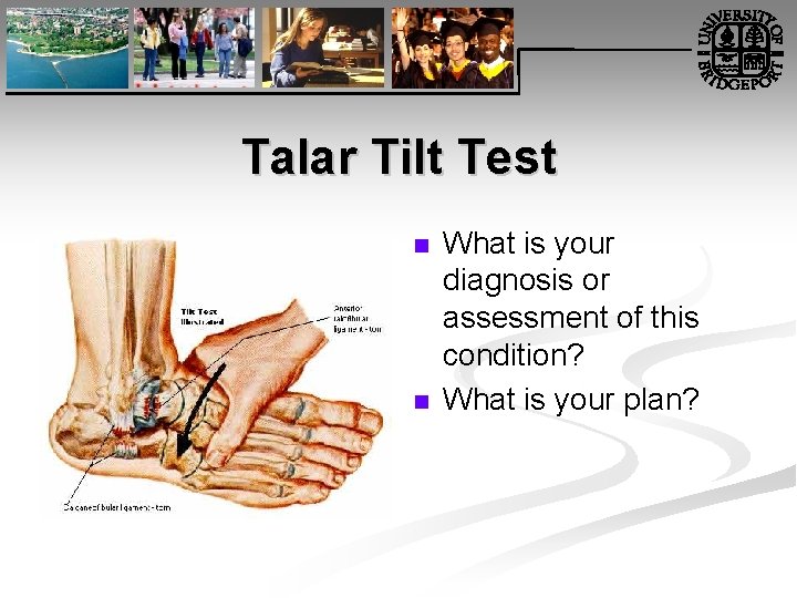 Talar Tilt Test n n What is your diagnosis or assessment of this condition?