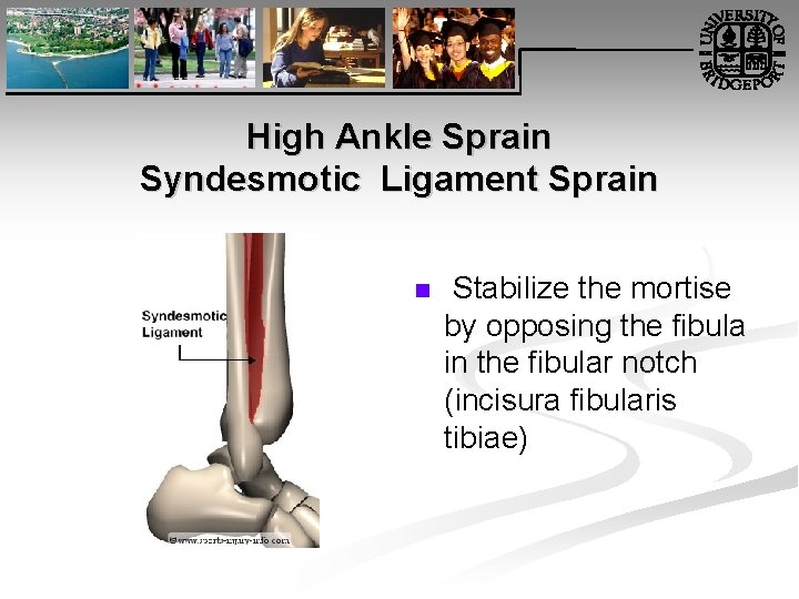 High Ankle Sprain Syndesmotic Ligament Sprain n Stabilize the mortise by opposing the fibula