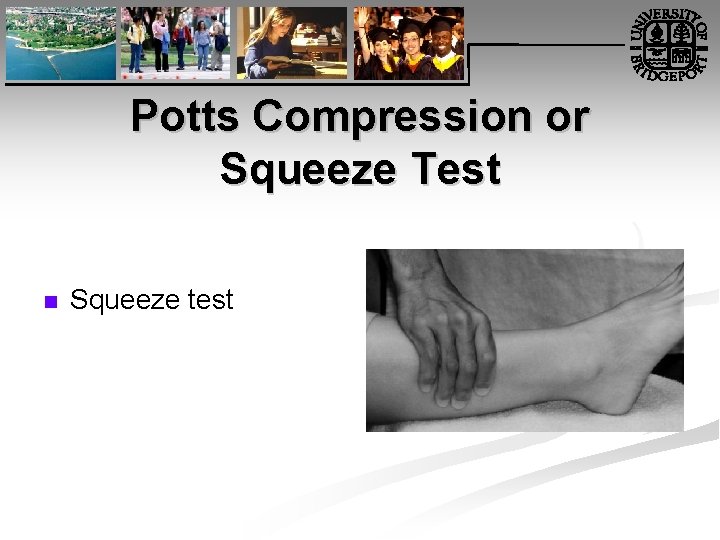 Potts Compression or Squeeze Test n Squeeze test 