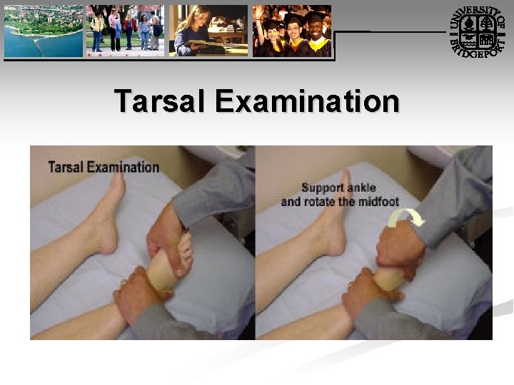 Tarsal Examination 