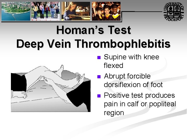 Homan’s Test Deep Vein Thrombophlebitis n n n Supine with knee flexed Abrupt forcible