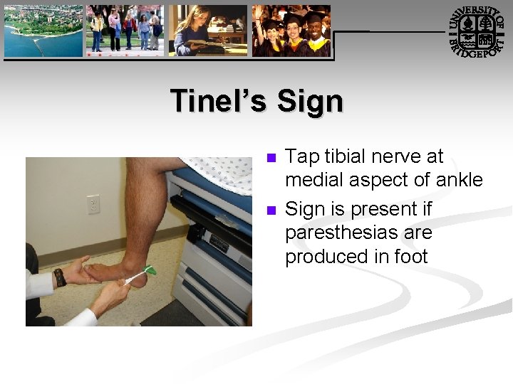 Tinel’s Sign n n Tap tibial nerve at medial aspect of ankle Sign is