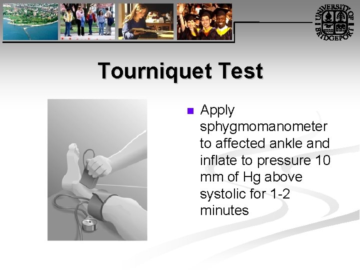Tourniquet Test n Apply sphygmomanometer to affected ankle and inflate to pressure 10 mm