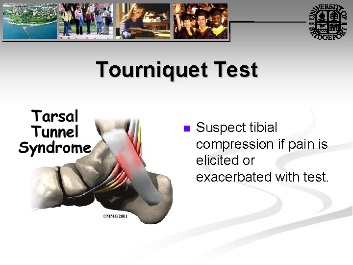 Tourniquet Test n Suspect tibial compression if pain is elicited or exacerbated with test.