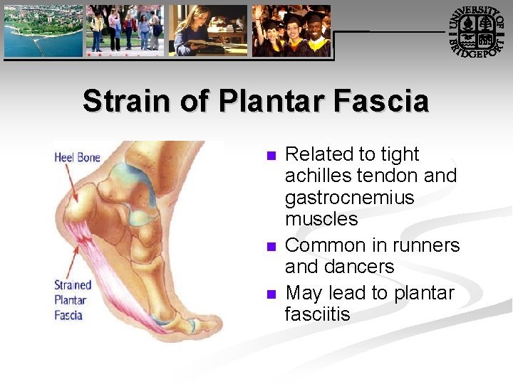 Strain of Plantar Fascia n n n Related to tight achilles tendon and gastrocnemius