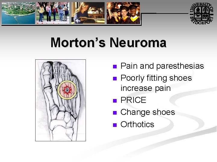 Morton’s Neuroma n n n Pain and paresthesias Poorly fitting shoes increase pain PRICE