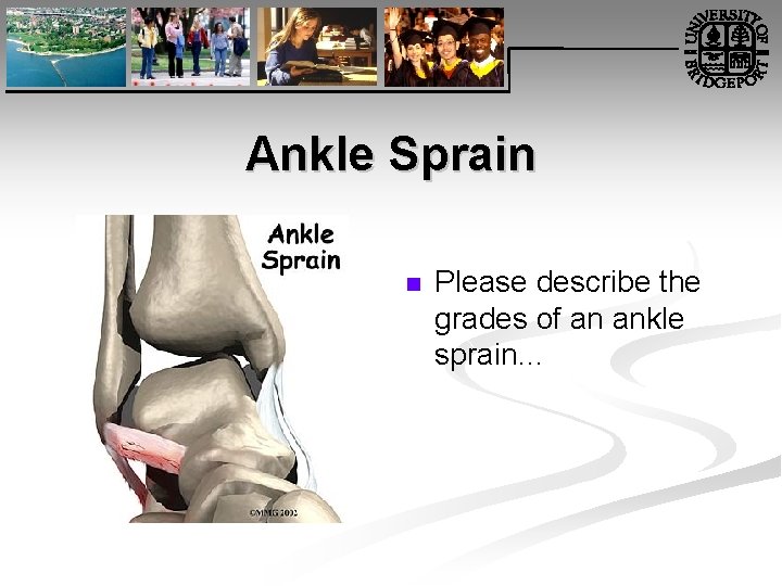 Ankle Sprain n Please describe the grades of an ankle sprain… 