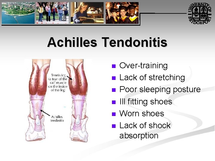 Achilles Tendonitis n n n Over-training Lack of stretching Poor sleeping posture Ill fitting