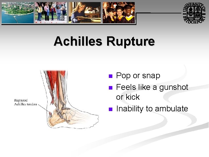 Achilles Rupture n n n Pop or snap Feels like a gunshot or kick