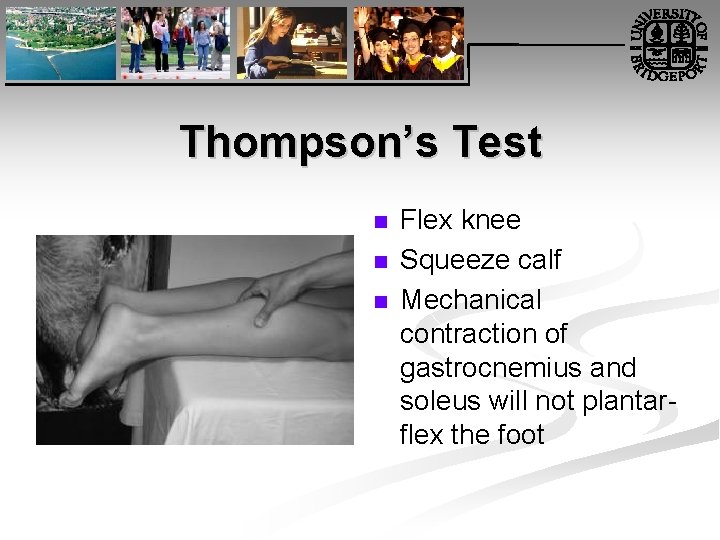 Thompson’s Test n n n Flex knee Squeeze calf Mechanical contraction of gastrocnemius and