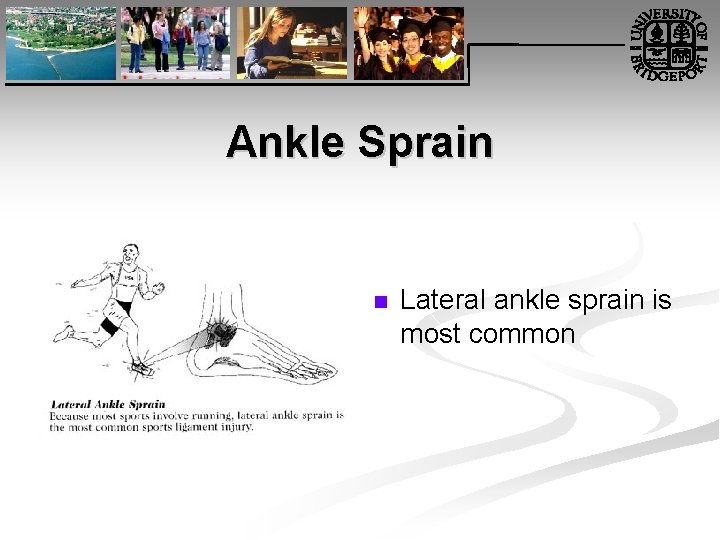 Ankle Sprain n Lateral ankle sprain is most common 