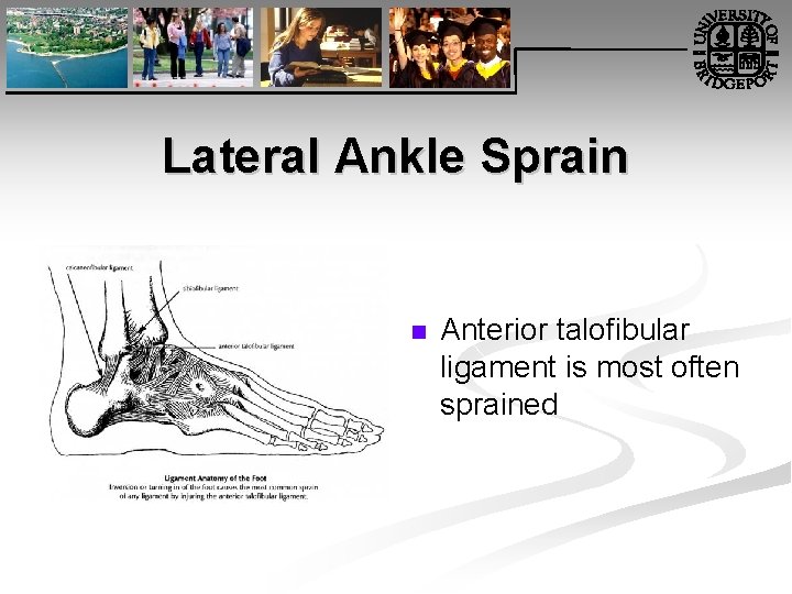 Lateral Ankle Sprain n Anterior talofibular ligament is most often sprained 