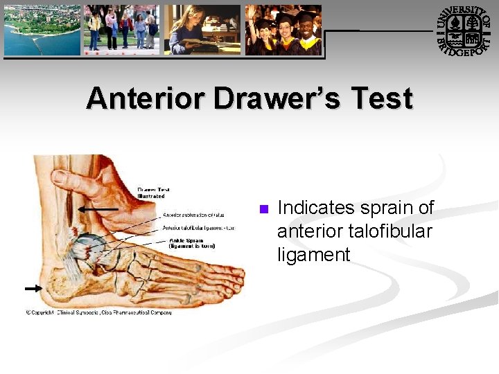 Anterior Drawer’s Test n Indicates sprain of anterior talofibular ligament 