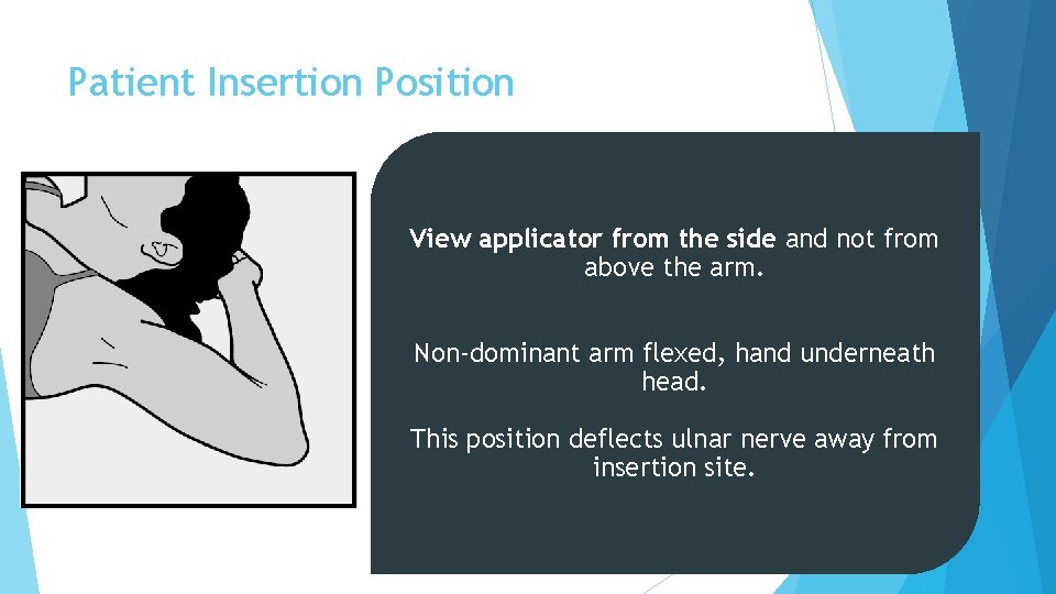 Patient Insertion Position View applicator from the side and not from above the arm.