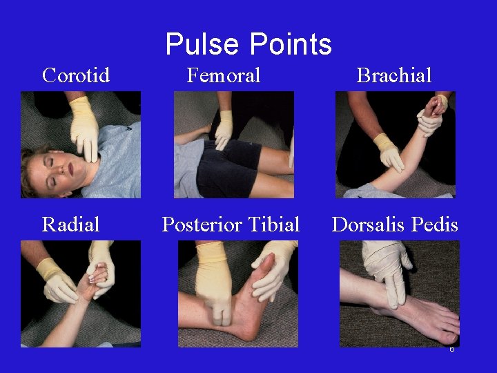 Pulse Points Corotid Radial Femoral Posterior Tibial Brachial Dorsalis Pedis 6 