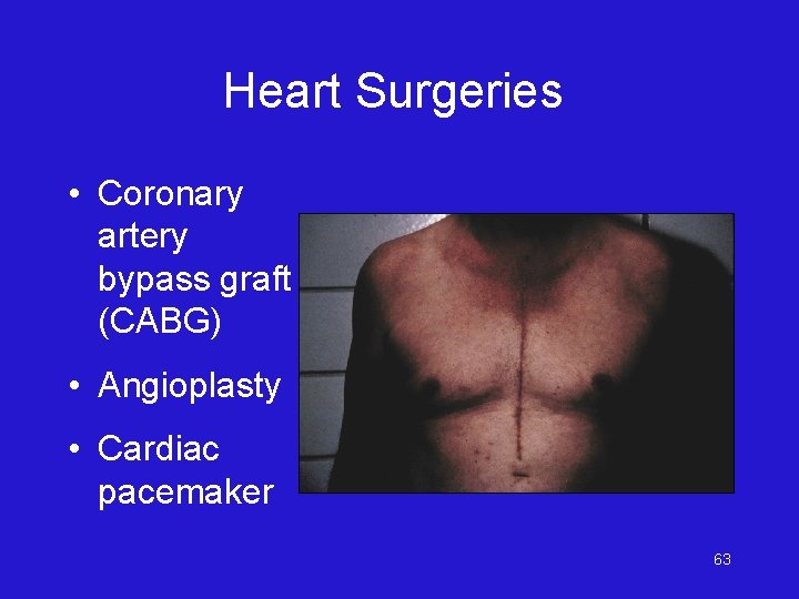 Heart Surgeries • Coronary artery bypass graft (CABG) • Angioplasty • Cardiac pacemaker 63