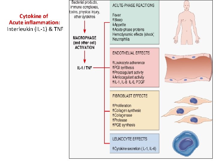 Cytokine of Acute inflammation: Interleukin (IL-1) & TNF 