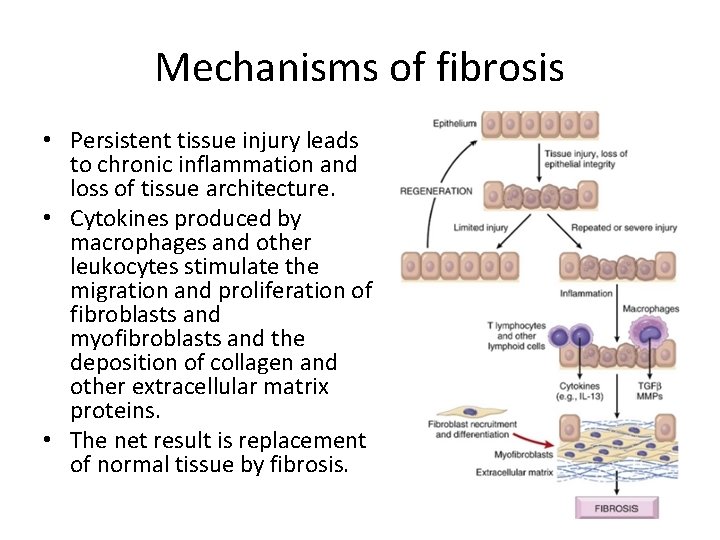 Mechanisms of fibrosis • Persistent tissue injury leads to chronic inflammation and loss of