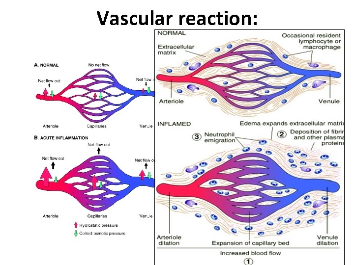Vascular reaction: 