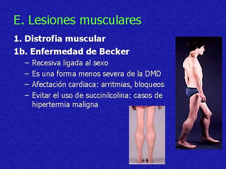 E. Lesiones musculares 1. Distrofia muscular 1 b. Enfermedad de Becker – – Recesiva
